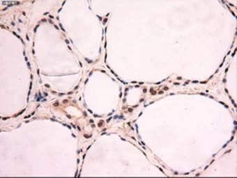 Anti-c-Myc antibody [3F2] used in IHC (Paraffin sections) (IHC-P). GTX84065