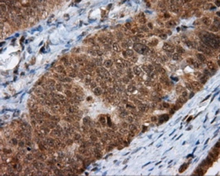 Anti-MTRF1L antibody [1B3] used in IHC (Paraffin sections) (IHC-P). GTX84071