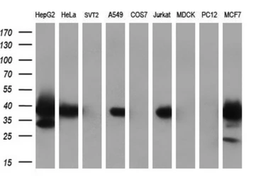 Anti-MRI1 antibody [6A10] used in Western Blot (WB). GTX84086