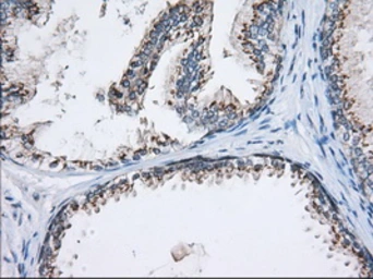 Anti-MOB1B antibody [3G9] used in IHC (Paraffin sections) (IHC-P). GTX84103