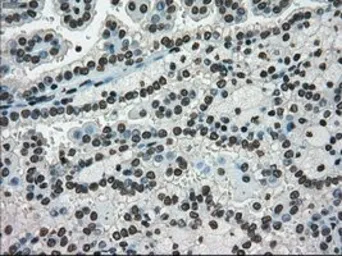 Anti-Ki67 antibody [3D11] used in IHC (Paraffin sections) (IHC-P). GTX84107