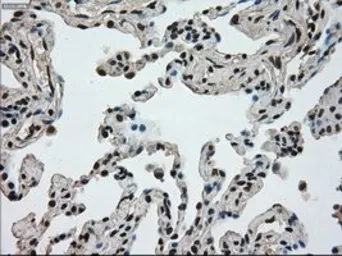 Anti-Ki67 antibody [3D11] used in IHC (Paraffin sections) (IHC-P). GTX84107