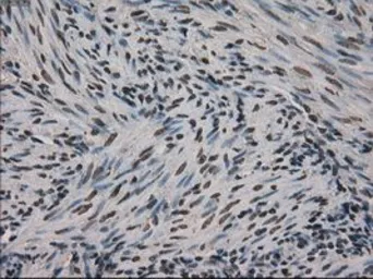 Anti-Ki67 antibody [3D11] used in IHC (Paraffin sections) (IHC-P). GTX84107