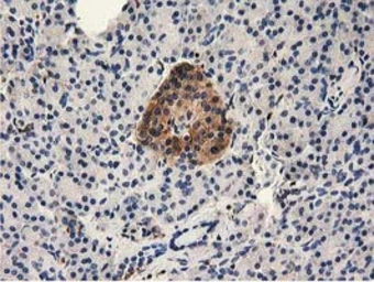 Anti-MICAL1 antibody [2H1] used in IHC (Paraffin sections) (IHC-P). GTX84125