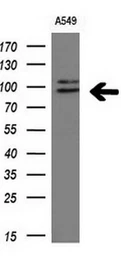 Anti-ERK3 antibody [5E1] used in Western Blot (WB). GTX84146