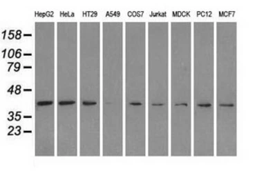 Anti-ERK2 antibody [4C2] used in Western Blot (WB). GTX84151