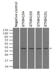 Anti-ERK2 antibody [4D10] used in Immunoprecipitation (IP). GTX84153