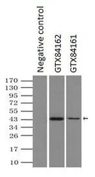 Anti-SEK1 / MKK4 antibody [8A8] used in Immunoprecipitation (IP). GTX84162