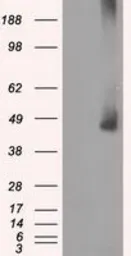 Anti-MEK1 antibody [1F5] used in Western Blot (WB). GTX84167