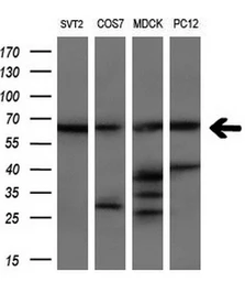Anti-LTA4H antibody [6B5] used in Western Blot (WB). GTX84173