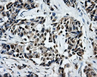 Anti-LOX antibody [6B11] used in IHC (Paraffin sections) (IHC-P). GTX84182