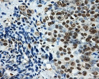 Anti-LOX antibody [6B11] used in IHC (Paraffin sections) (IHC-P). GTX84182