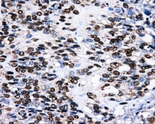 Anti-LOX antibody [6B11] used in IHC (Paraffin sections) (IHC-P). GTX84182