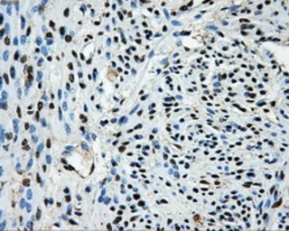 Anti-LOX antibody [6B11] used in IHC (Paraffin sections) (IHC-P). GTX84182