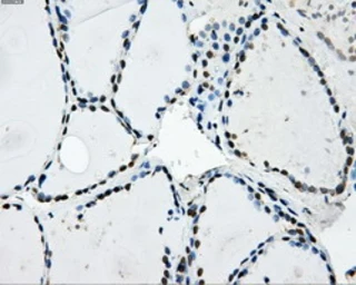 Anti-LOX antibody [6B11] used in IHC (Paraffin sections) (IHC-P). GTX84182