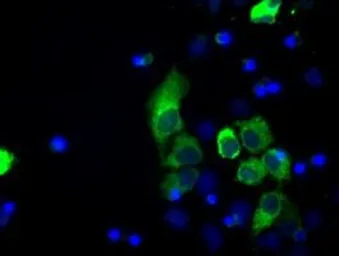 Anti-LOX antibody [6B11] used in Immunocytochemistry/ Immunofluorescence (ICC/IF). GTX84182