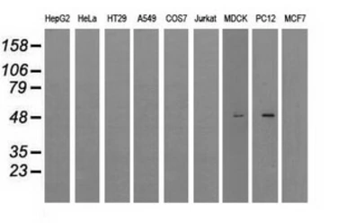 Anti-LOX antibody [5C4] used in Western Blot (WB). GTX84188