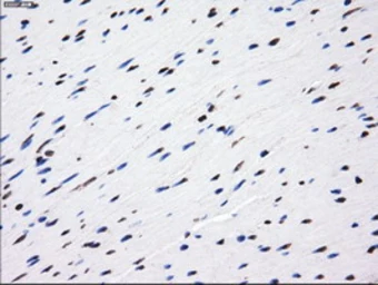 Anti-LOX antibody [9A11] used in IHC (Paraffin sections) (IHC-P). GTX84189