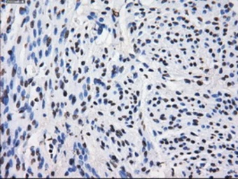 Anti-LOX antibody [9A11] used in IHC (Paraffin sections) (IHC-P). GTX84189
