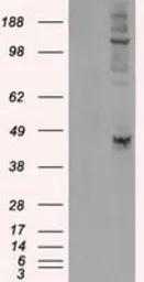 Anti-LOX antibody [9A11] used in Western Blot (WB). GTX84189