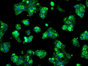 Anti-LOX antibody [9A11] used in Immunocytochemistry/ Immunofluorescence (ICC/IF). GTX84189