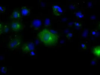 Anti-Endothelial Lipase / LIPG antibody [2A5] used in Immunocytochemistry/ Immunofluorescence (ICC/IF). GTX84195