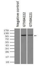 Anti-LEMD3 antibody [3H1] used in Immunoprecipitation (IP). GTX84221