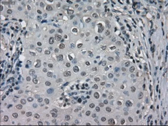 Anti-LDHA antibody [2D11] used in IHC (Paraffin sections) (IHC-P). GTX84227