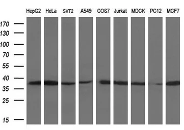 Anti-LDHA antibody [2D11] used in Western Blot (WB). GTX84227