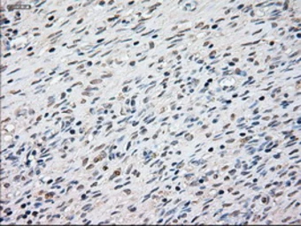 Anti-Cytokeratin 8 antibody [4D12] used in IHC (Paraffin sections) (IHC-P). GTX84248