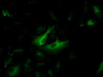 Anti-Cytokeratin 8 antibody [4D12] used in Immunocytochemistry/ Immunofluorescence (ICC/IF). GTX84248