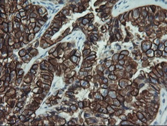 Anti-Cytokeratin 19 antibody [3F8] used in IHC (Paraffin sections) (IHC-P). GTX84251