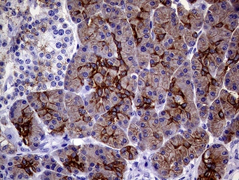 Anti-Cytokeratin 18 antibody [1E1] used in IHC (Paraffin sections) (IHC-P). GTX84256