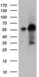 Anti-KLHL2 antibody [1G7] used in Western Blot (WB). GTX84259