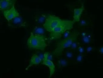 Anti-KLHL2 antibody [1G7] used in Immunocytochemistry/ Immunofluorescence (ICC/IF). GTX84259