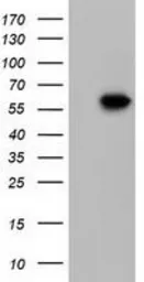 Anti-KLHL2 antibody [6D8] used in Western Blot (WB). GTX84261