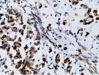 Anti-Ketohexokinase antibody [3D1] used in IHC (Paraffin sections) (IHC-P). GTX84277