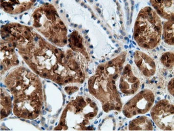 Anti-Ketohexokinase antibody [3D1] used in IHC (Paraffin sections) (IHC-P). GTX84277