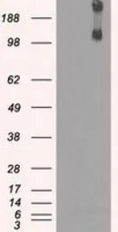 Anti-KDM4C antibody [5B9] used in Western Blot (WB). GTX84280