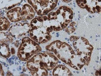 Anti-IVD antibody [1B10] used in IHC (Paraffin sections) (IHC-P). GTX84285