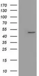 Anti-IVD antibody [1B10] used in Western Blot (WB). GTX84285