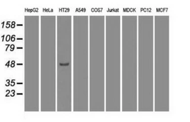 Anti-IRF3 antibody [4D4] used in Western Blot (WB). GTX84288