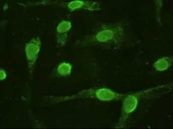 Anti-IL6 antibody [3G9] used in Immunocytochemistry/ Immunofluorescence (ICC/IF). GTX84291
