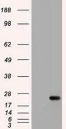 Anti-IL6 antibody [3G9] used in Western Blot (WB). GTX84291