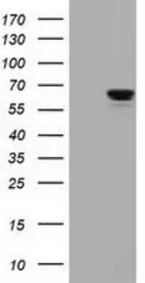 Anti-IGF2BP2 antibody [4F7] used in Western Blot (WB). GTX84309