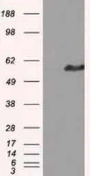 Anti-HIPPI antibody [2G3] used in Western Blot (WB). GTX84311