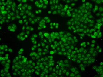 Anti-IFIT3 antibody [1G1] used in Immunocytochemistry/ Immunofluorescence (ICC/IF). GTX84314