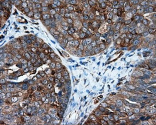 Anti-IFIT1 antibody [3G8] used in IHC (Paraffin sections) (IHC-P). GTX84315