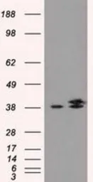Anti-IDH3A antibody [2F11] used in Western Blot (WB). GTX84317
