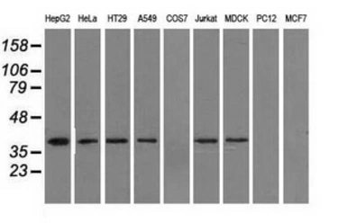 Anti-IDH3A antibody [2F11] used in Western Blot (WB). GTX84317